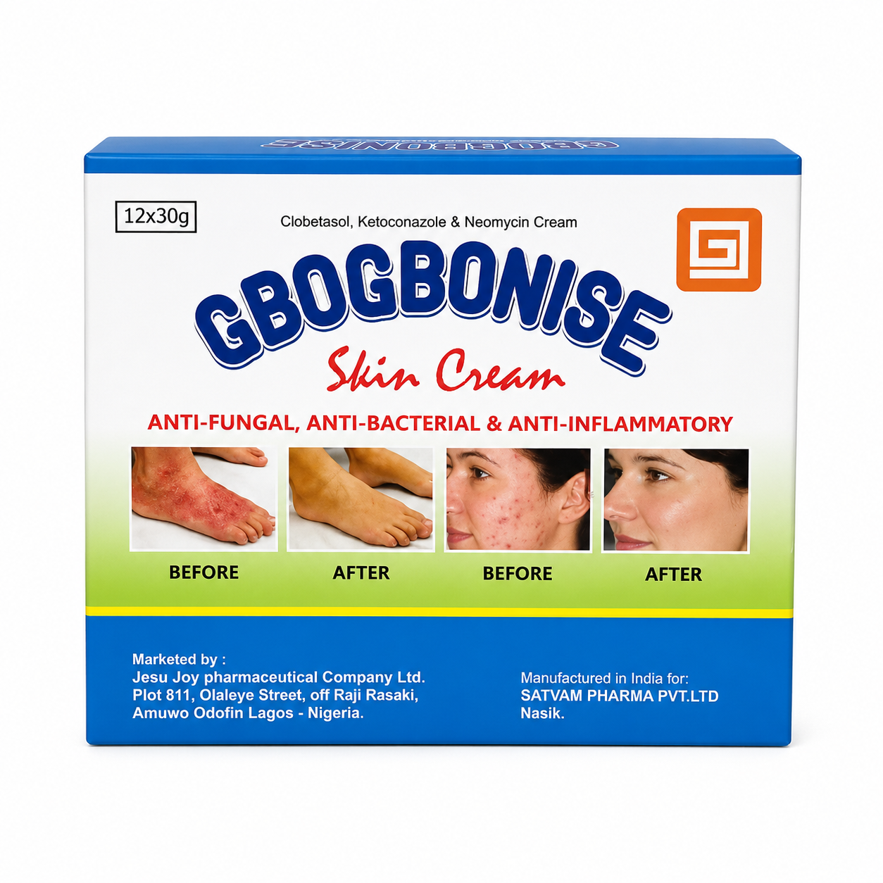 Cbogbonise Skin Cream – Anti-Fungal, Anti-Bacterial & Anti-Inflammatory Cream