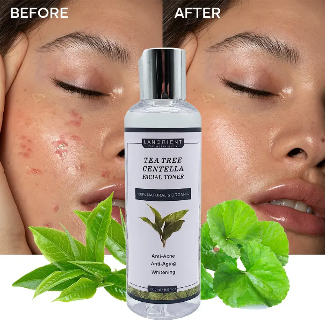 Lanorient Tea Tree Centella Facial Toner – Anti Acne & Brightening Toner