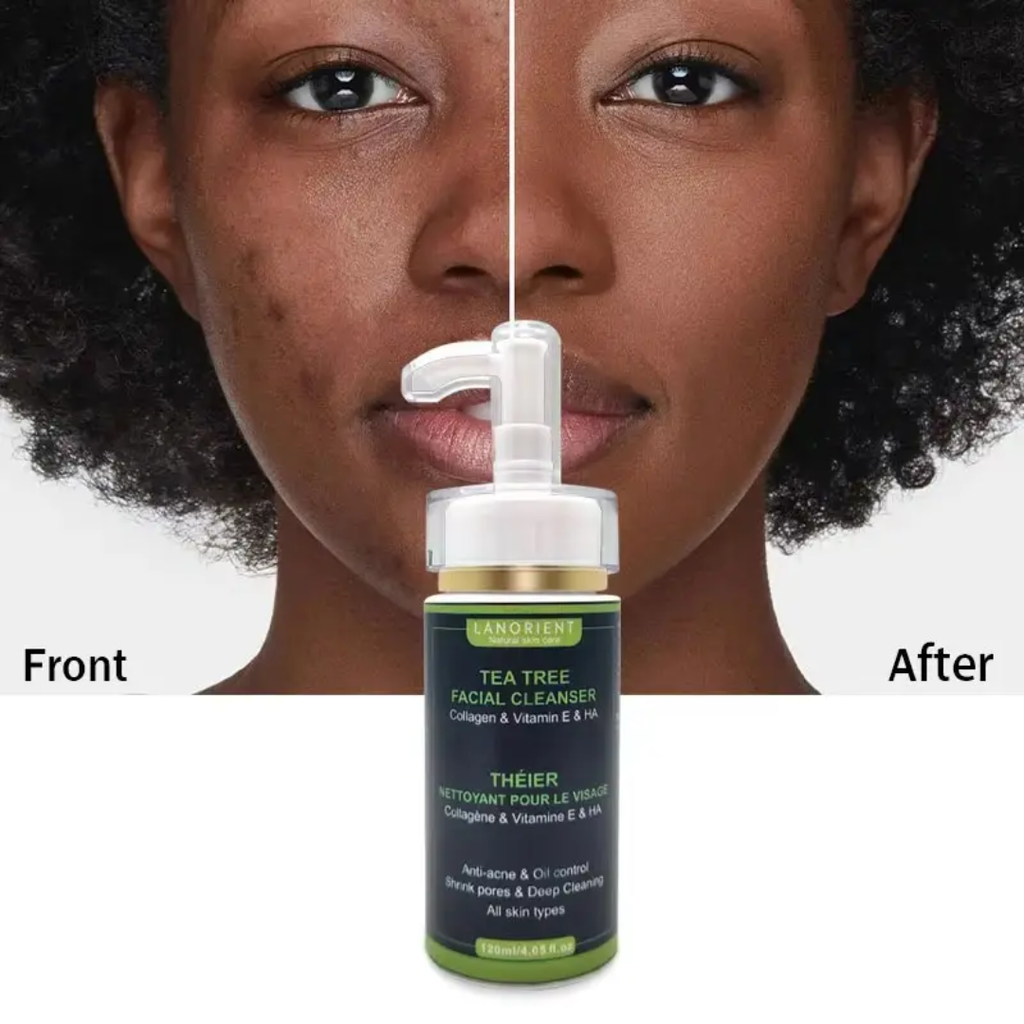 Lanorient Tea Tree Facial Cleanser – Anti Acne & Oil Control Face Wash